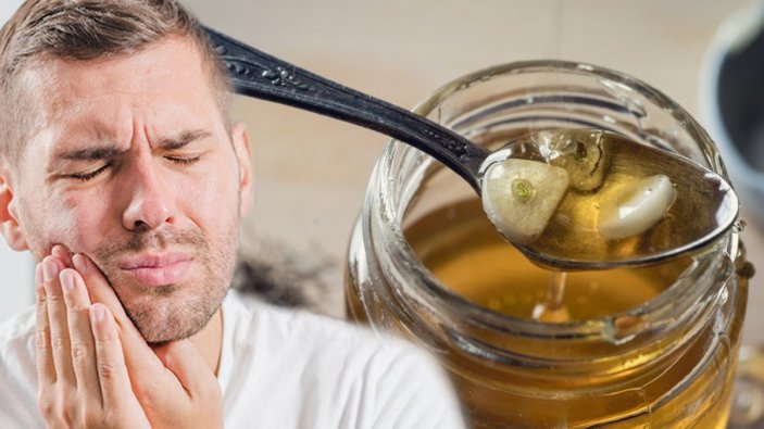 Diş ağrısını bıçak gibi kesen mucizevi karışım!  Bir çay askısı yetiyor...