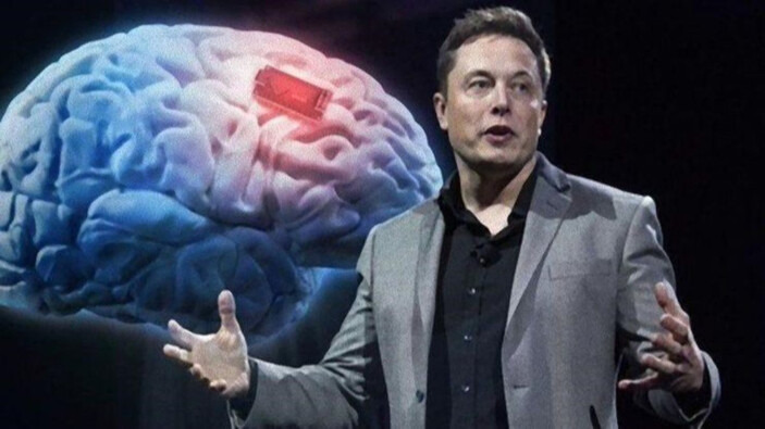 Elon Musk, insan beynine çip takmak için ortak arıyor